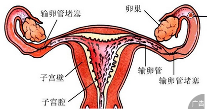 女性要关注子宫性不孕的原因