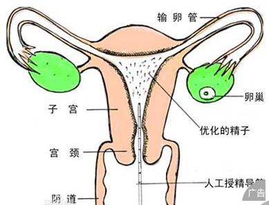 女性免疫性不孕的症状