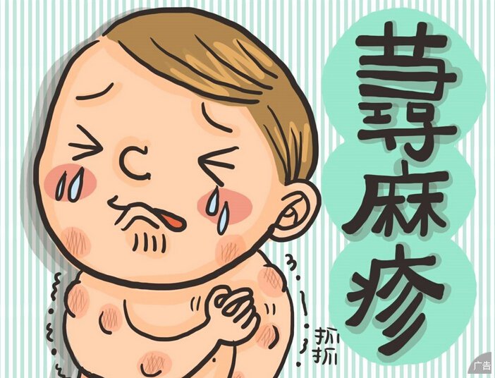 导致荨麻疹的病因你清楚吗