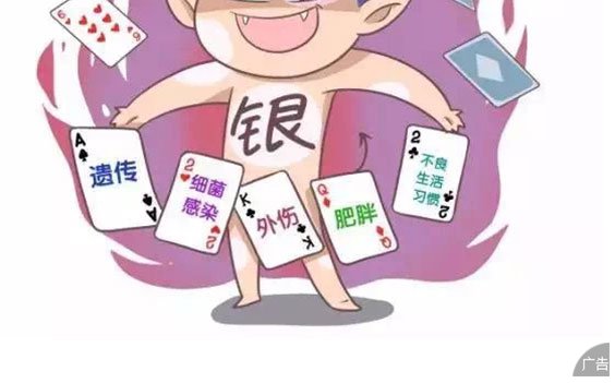 银屑病主要有什么症状呢