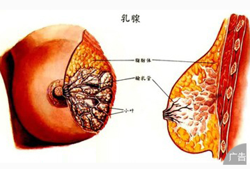 乳腺增生严重吗