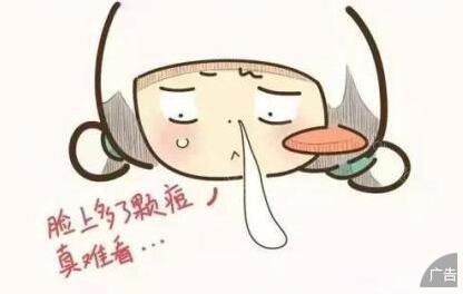 导致痤疮的原因都有什么