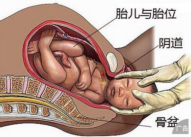 产程迟滞会带来哪些影响